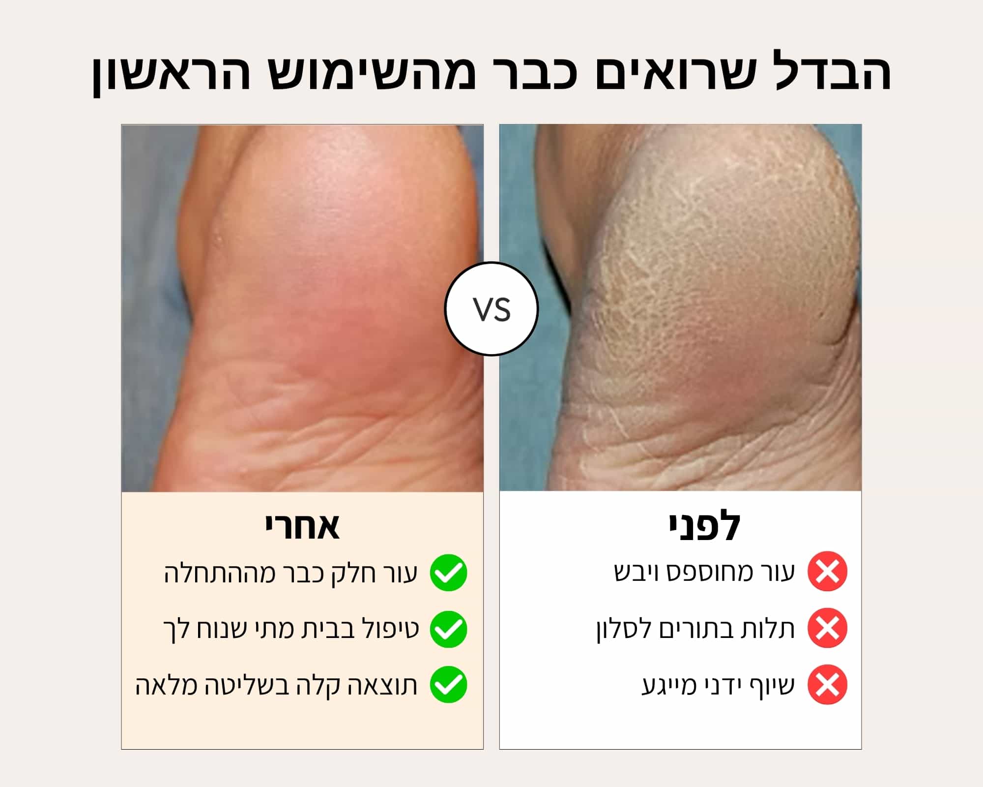 פדיקור אלחוטי - ™VELMU Silk